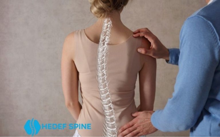 Skolyoz Tedavisinde Skolyoz Korsesi Kullanımı