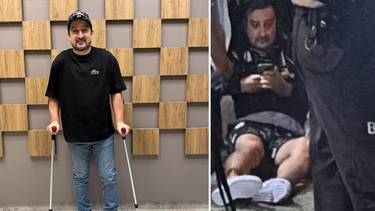 Yayından sonra ayağından vuruldu! Serhat Akın’dan 3 ay sonra paylaşım…